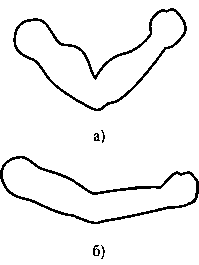 Каплевидные” мускулы руки человека